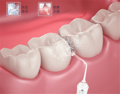 家庭口腔清潔新寵 為何這個(gè)品牌正悄然超越潔碧，成為水牙線首選
